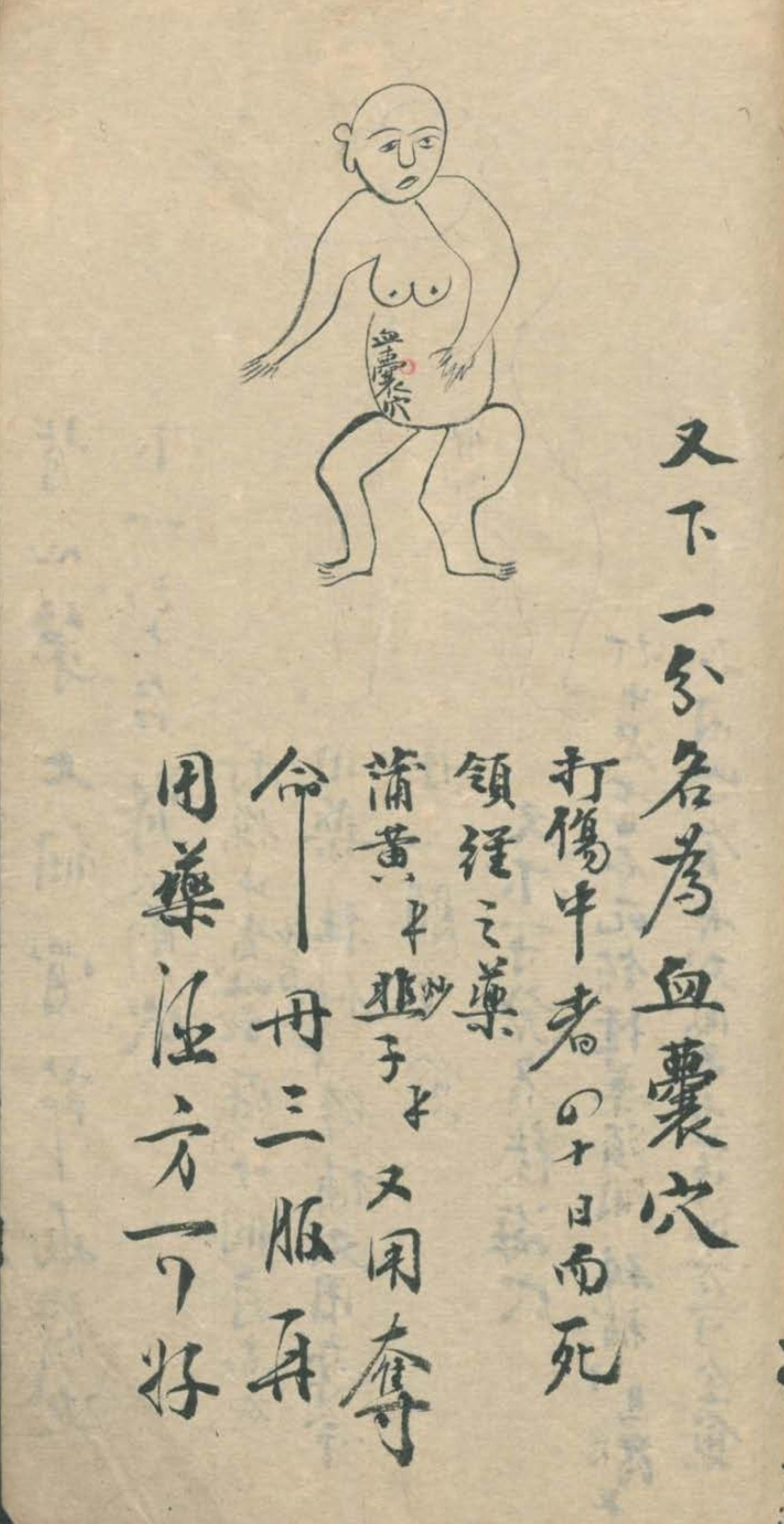 武当秘传跌打八法,民间中医古籍手抄本专医跌打秘方