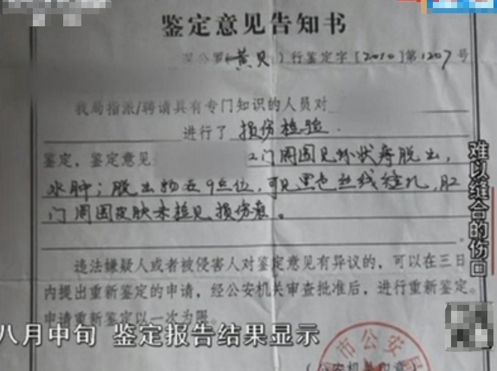 因嫌家属红包太少，助产士缝住产妇“肛门”？真相如何？