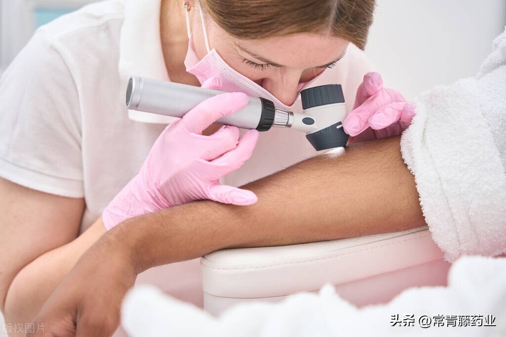 激光点痣和点痣笔点痣有什么区别,激光点痣药水点痣有致癌风险吗