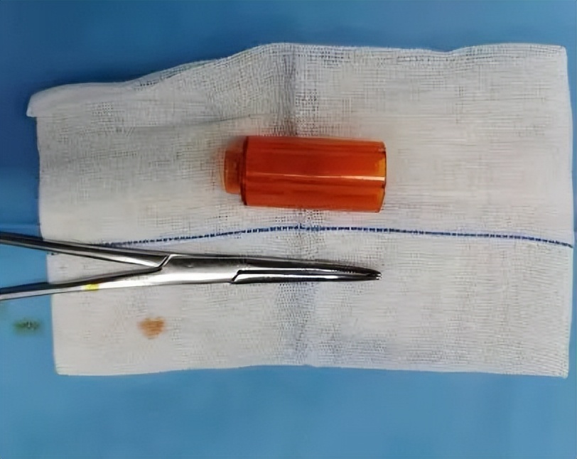 小孩裤头有褐色分泌物是什么原因,五岁宝宝裤子上有血怎么回事