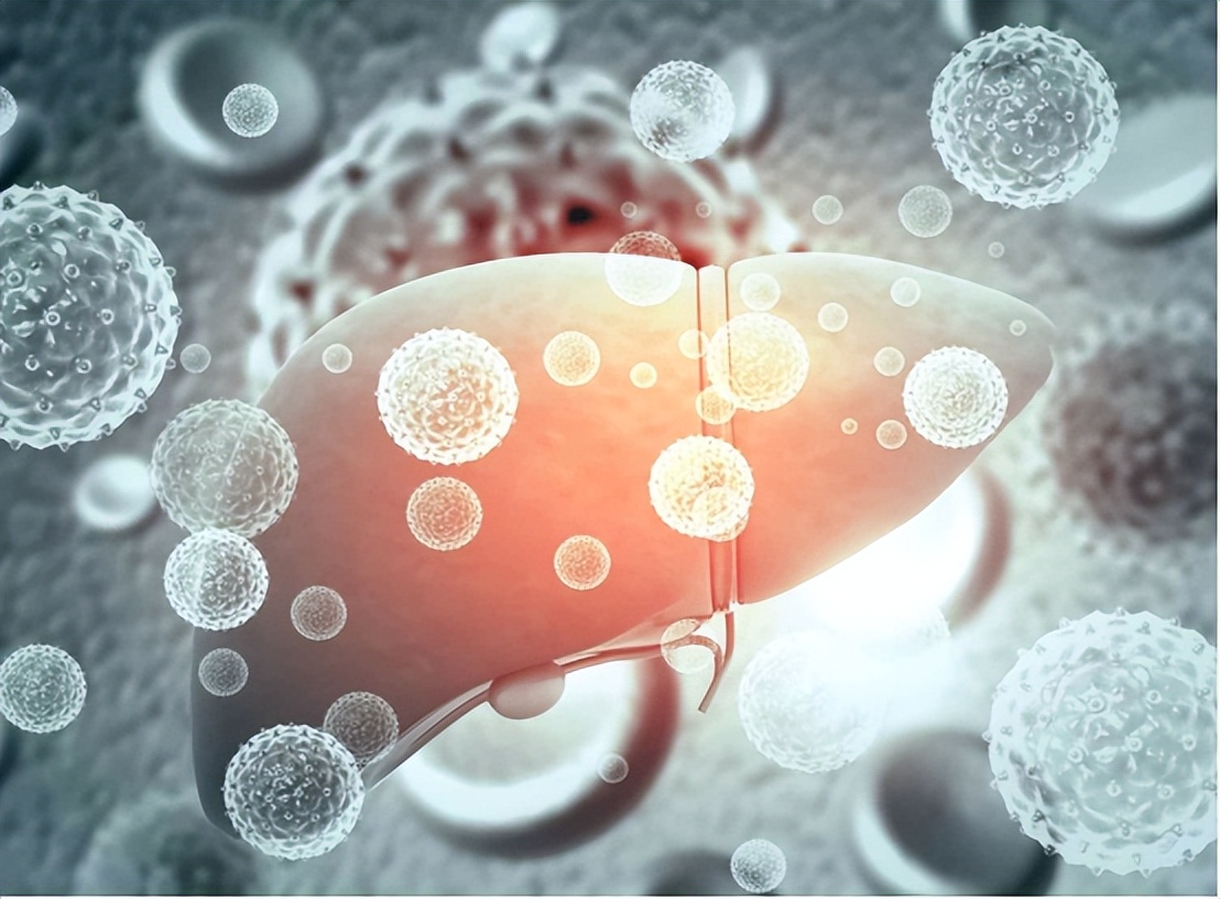 乙肝肝纤维化，怎样预防和治疗？以下方法告诉你