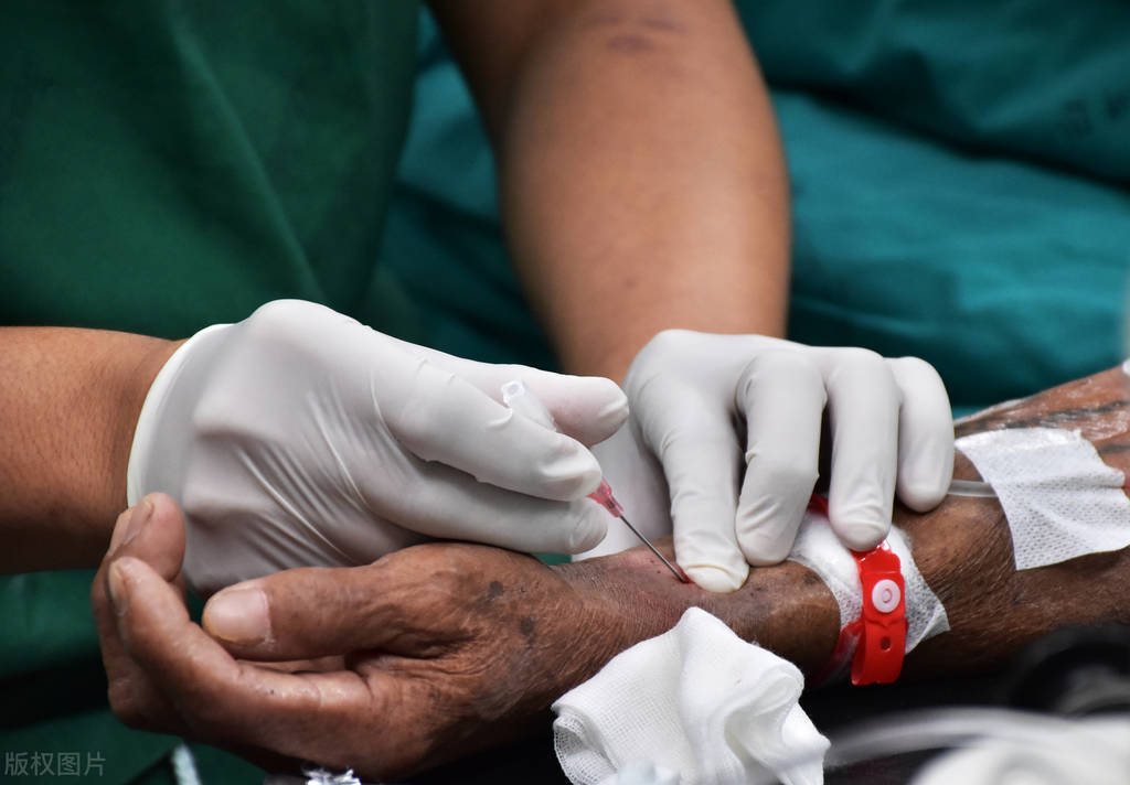 突发急性心梗做支架,急性心梗溶栓后还需要支架治疗吗