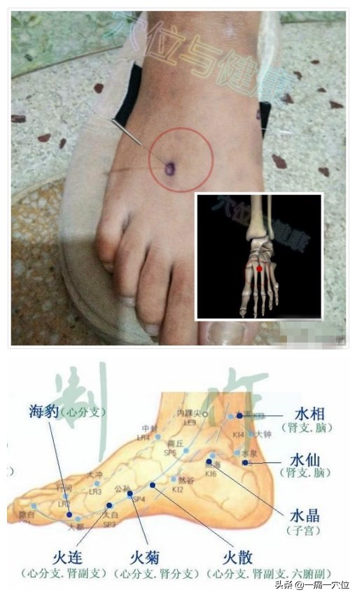 7-10级偏头痛,偏头痛缓解头痛新招数患者必看
