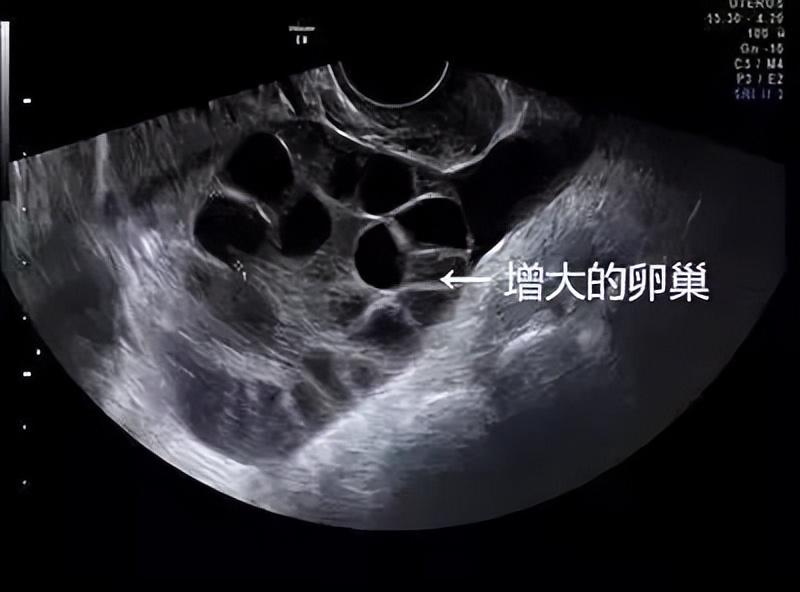 高校女生兼职的真实经历,大学校园兼职陷阱