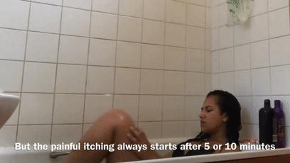 对水过敏的人怎么喝水,怎么会对水过敏