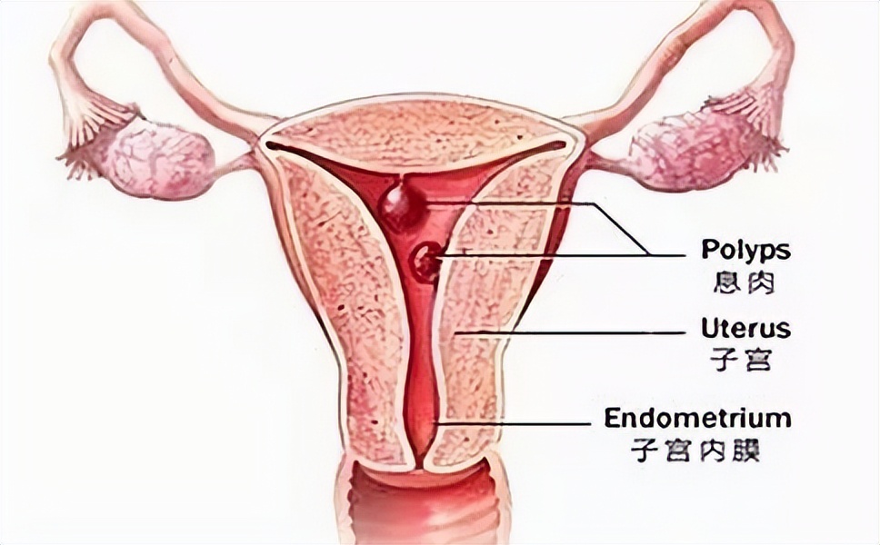 派特生物派特灵治疗hpv有效果吗,派特灵和派特舒尔一起怎么使用