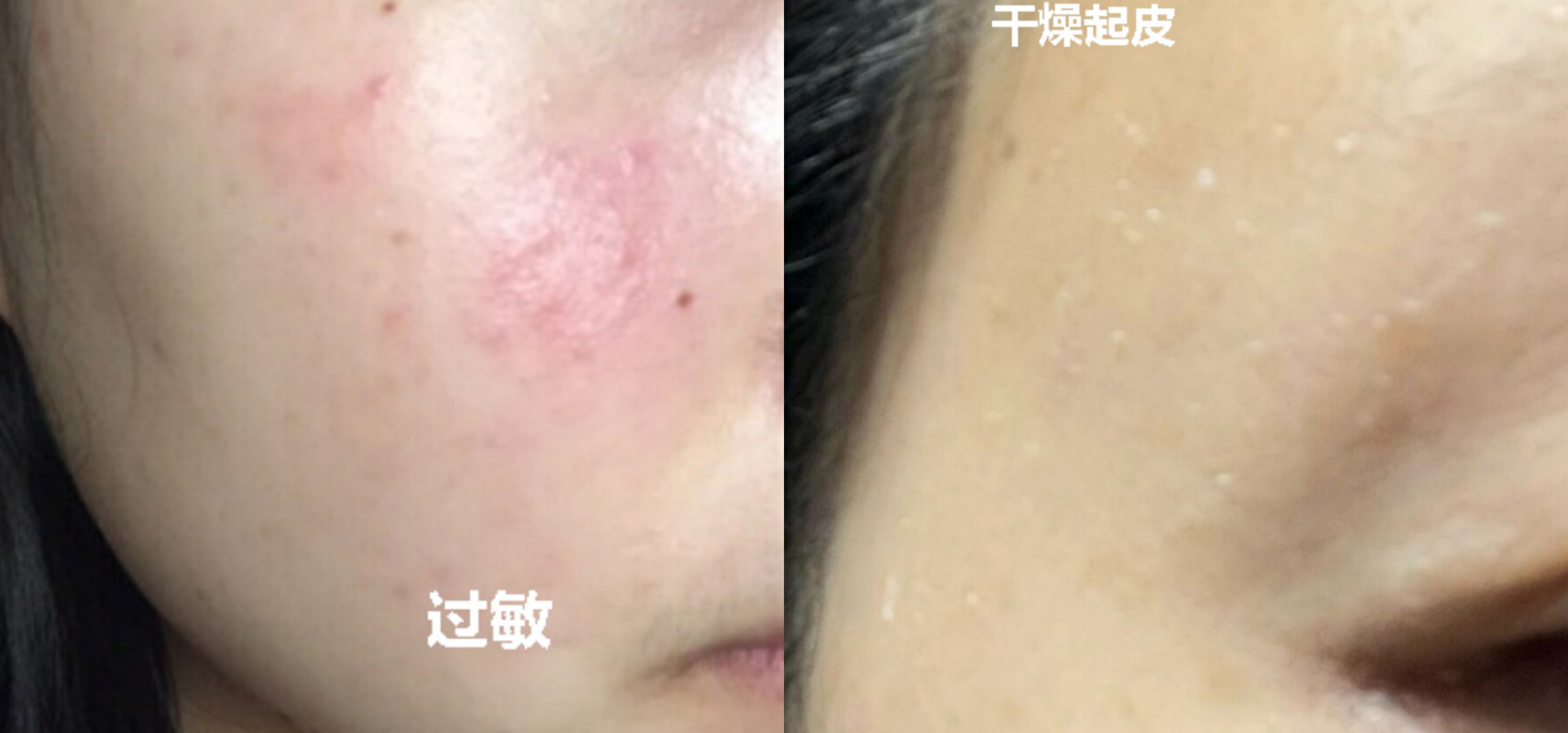 适合冬季孕妇用的大牌保湿水乳,孕妇可用抗老美白水乳推荐