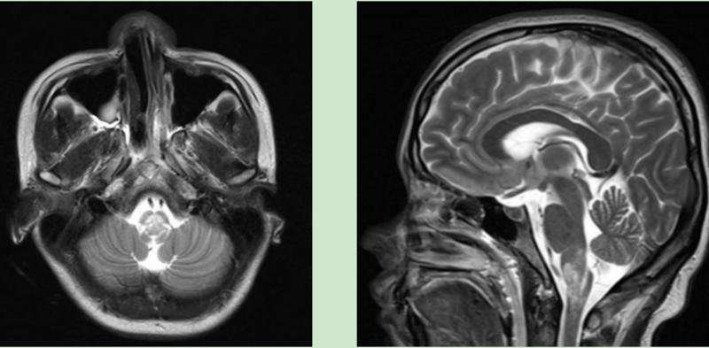 头晕呕吐自救方法,突然头晕站不稳呕吐注意什么