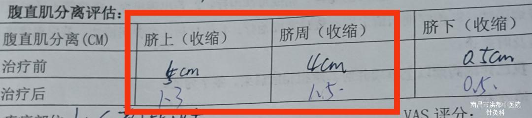 生娃后一直瘦不下去,生过孩子多久可以做小蛮腰