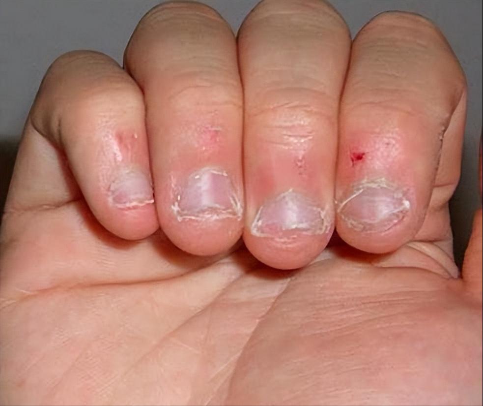 12岁小孩子老是啃手指是什么原因,小孩爱啃手指用什么方法解决