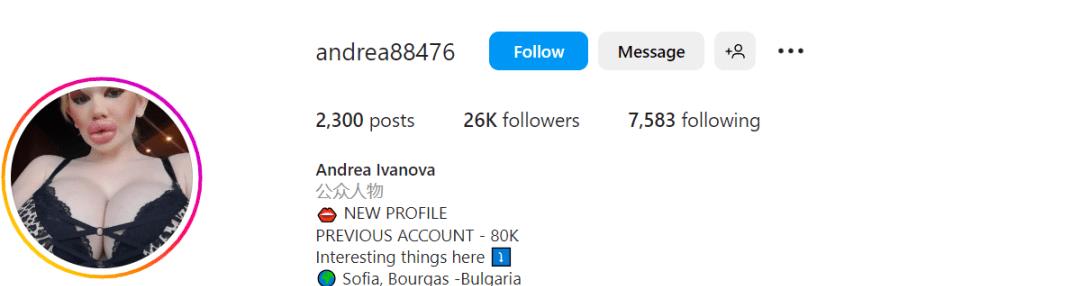 全网最厚嘴唇女网红,整容很多次网红厚嘴唇