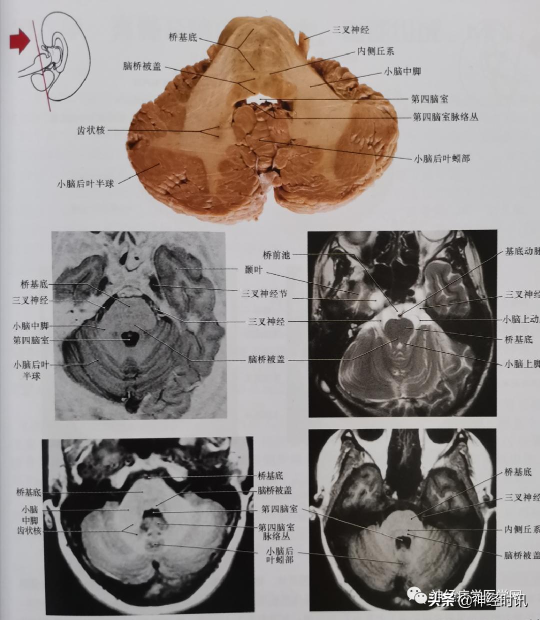 ct袖珍断层解剖图谱最新版,头颅ct断层解剖图谱无水印
