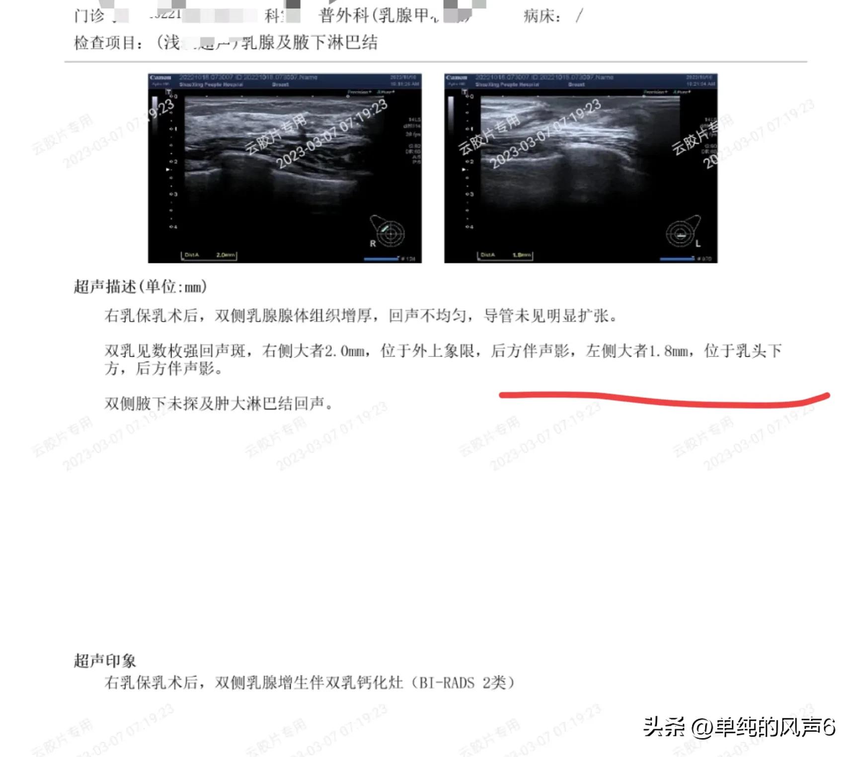 乳腺癌复查后肝内偏高回声区血管瘤各项指标都异常要不要复查？