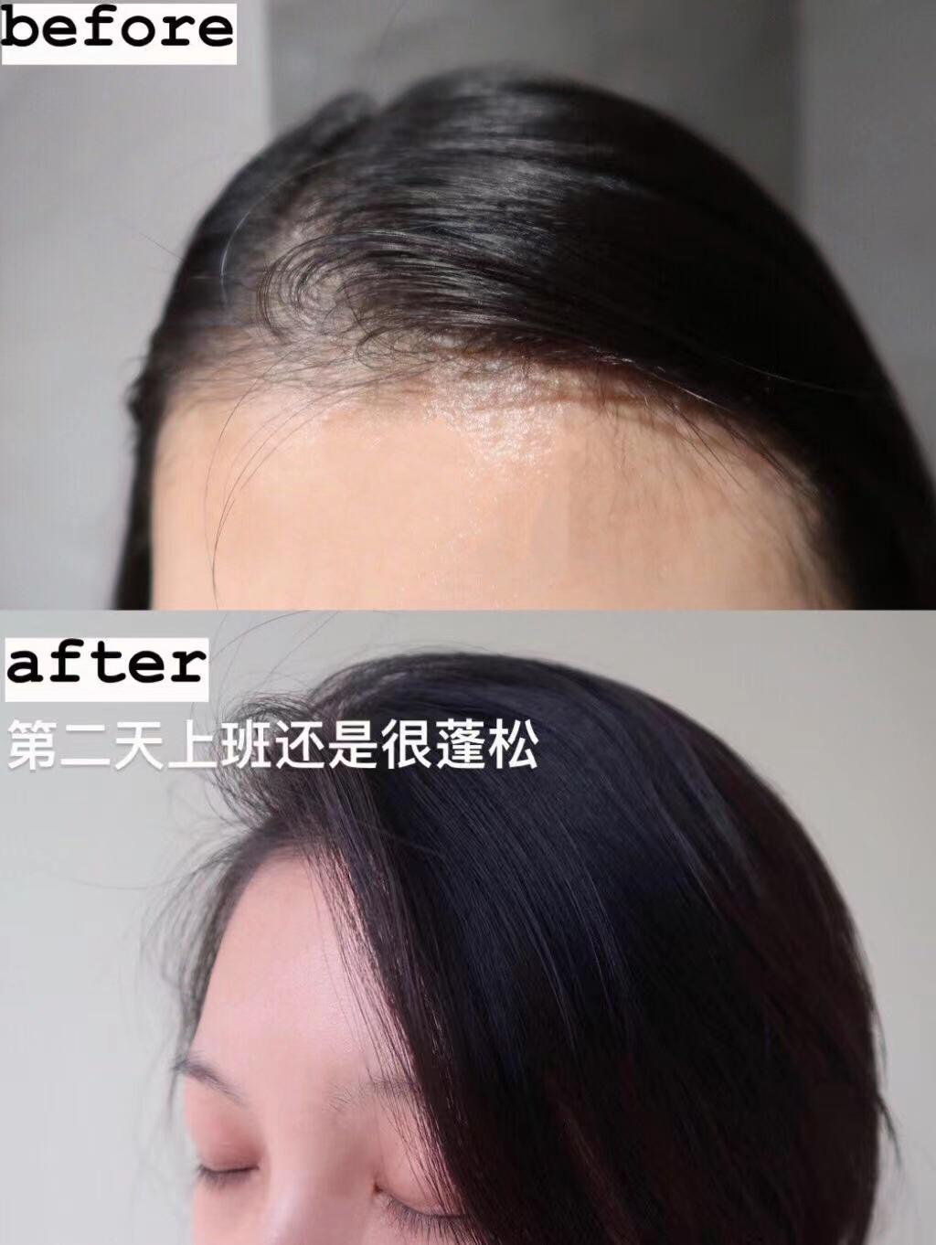 洗发水满婷去屑,洗发水白名单