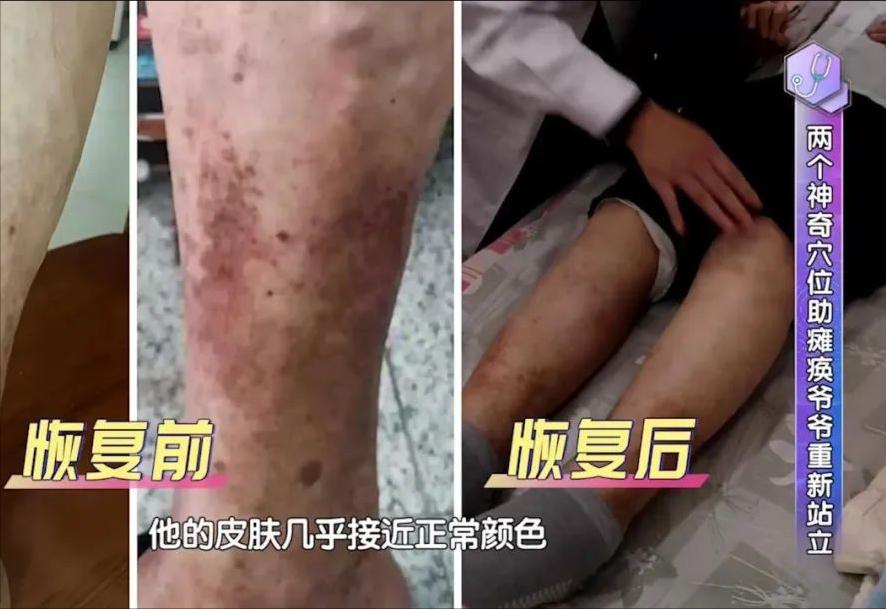 教你九招护腰秘诀,国家级老中医养腰秘诀