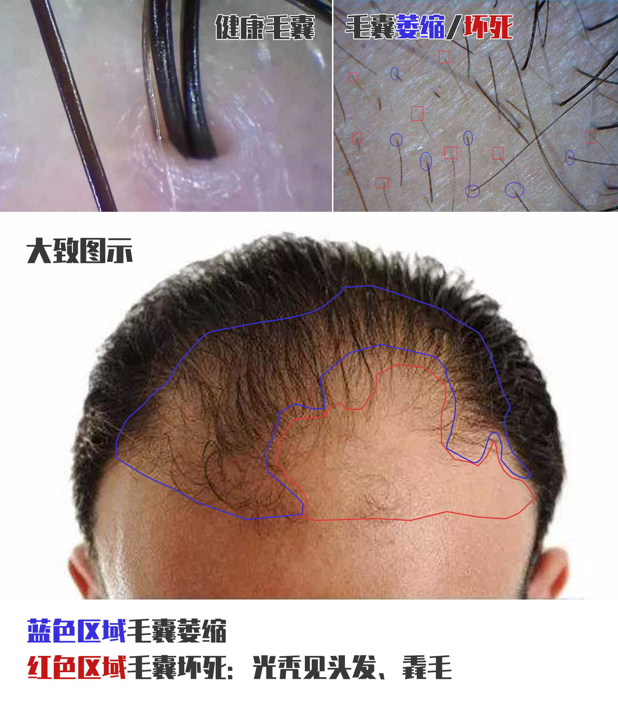 关于脱发目前真的能治吗,脱发多久就不能治愈了