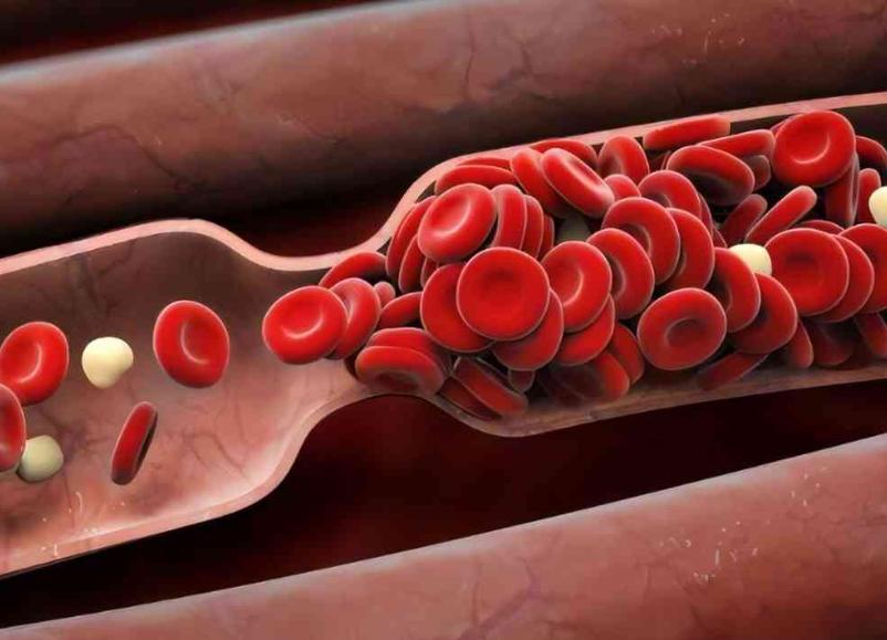 肝癌血小板低怎么补最快最有效,胃癌血小板低怎么补最快最有效