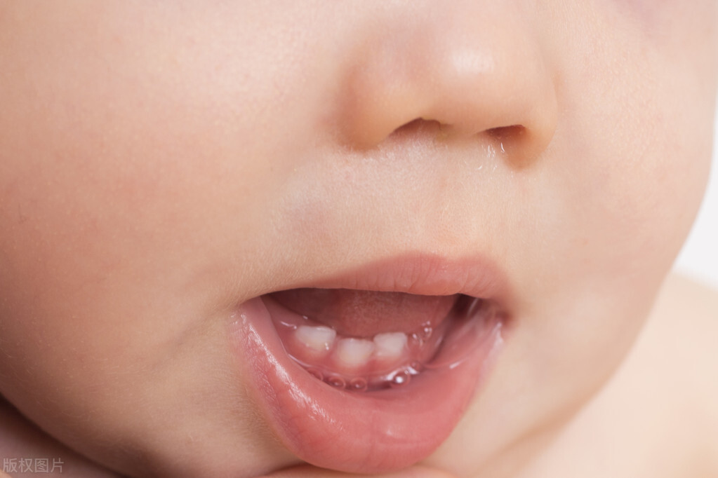 宝宝出生就有一颗牙是怎么回事,刚出生的婴儿长乳牙怎么办