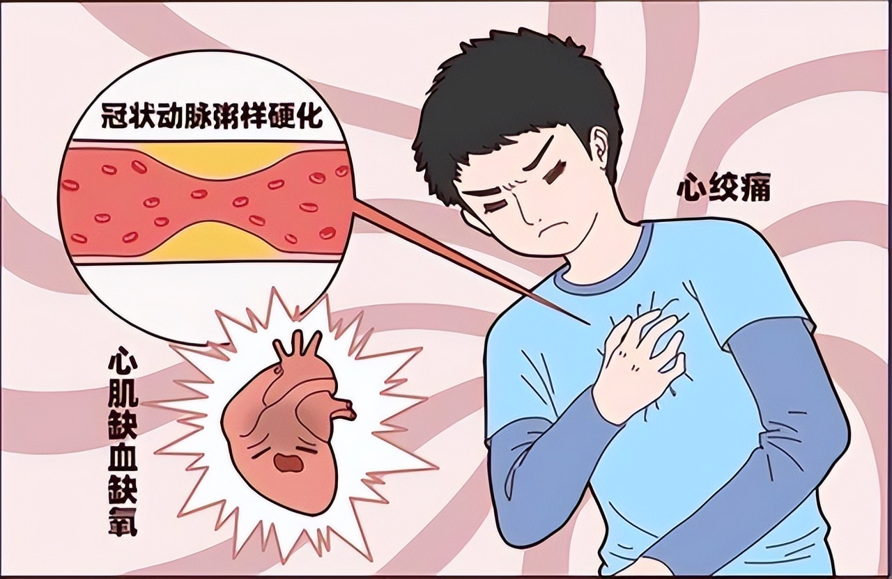 中西医结合治疗心绞痛效果更好,治疗心绞痛用丹参还是紫丹参