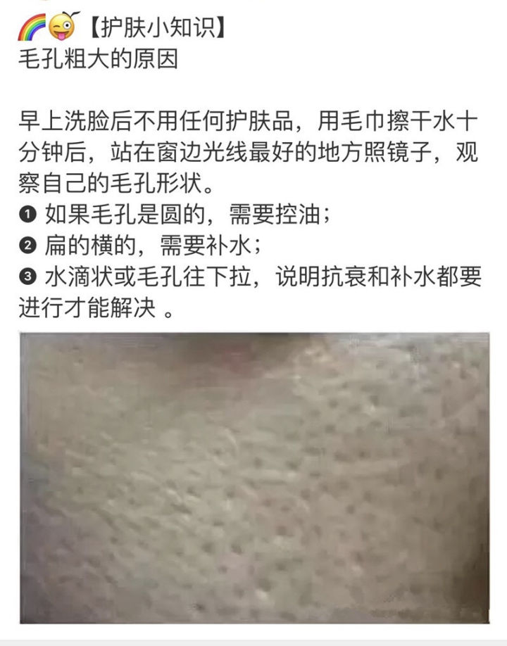 维a酸乳膏可以改善毛孔粗大吗,油皮毛孔粗大黑头多要怎么改善