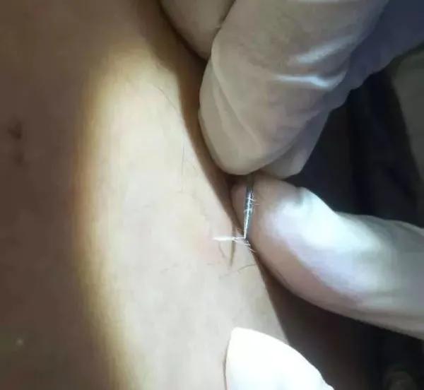 中医会后继无人吗？