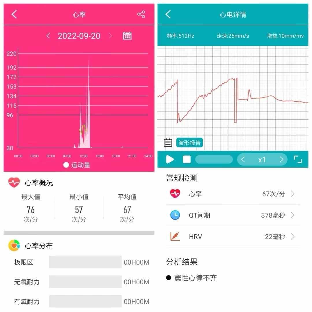 dido智能手表g28spro开机,DidoG28SPro手表