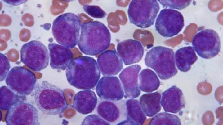 乳腺癌疫情期间去不了医院怎么办,疫情期间买不到激素药