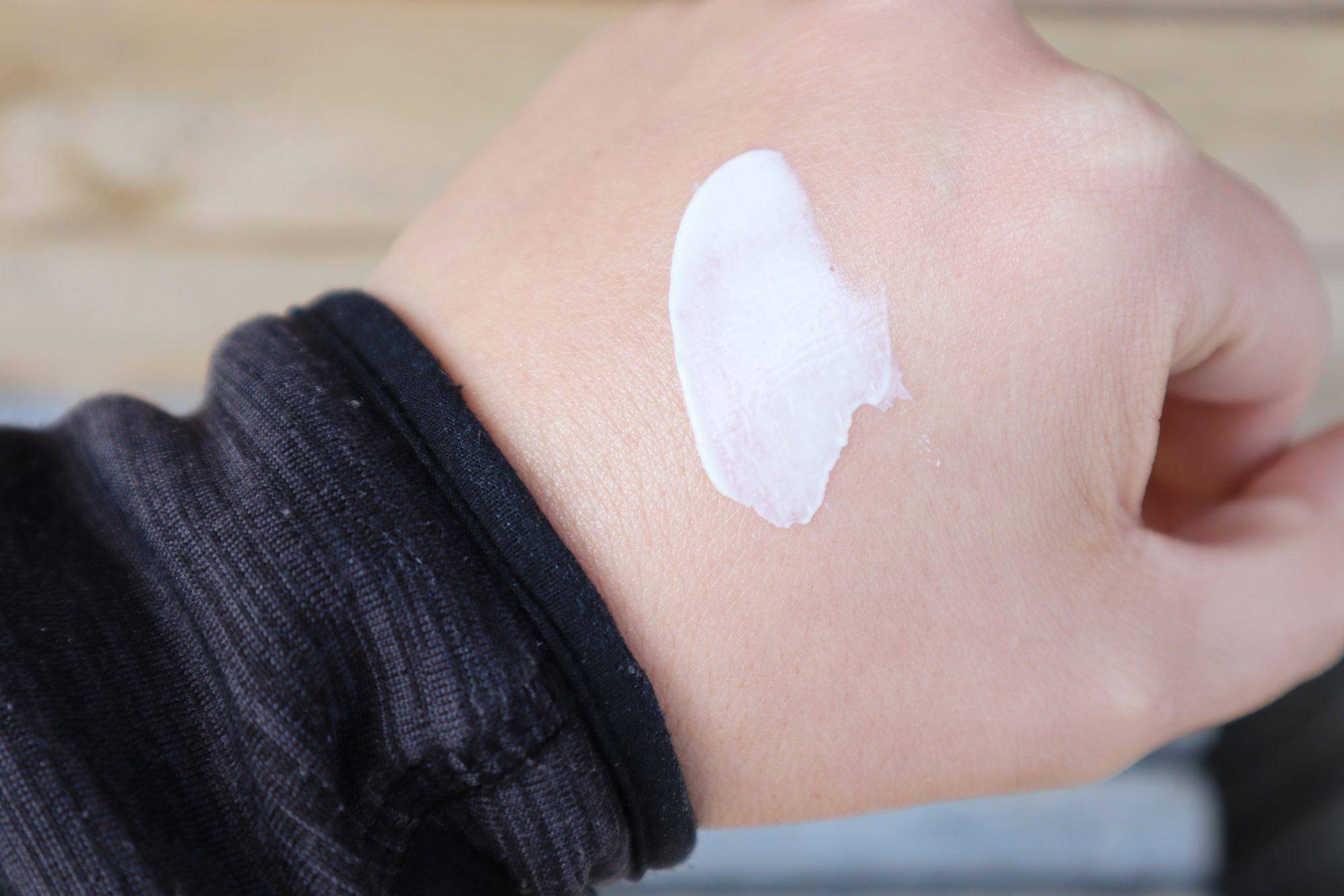 假期治痘最佳时期,如何快速消除熬夜痘