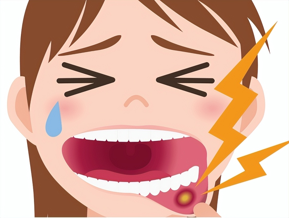 小儿口疮怎么治好得快,舌头上频繁长口疮是怎么回事