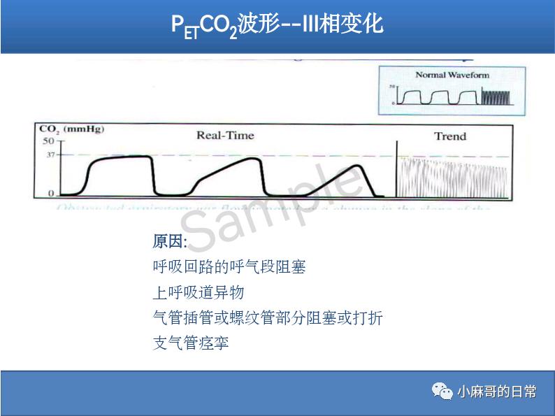 呼气末二氧化碳检测图的解读,呼气末二氧化碳检测操作视频