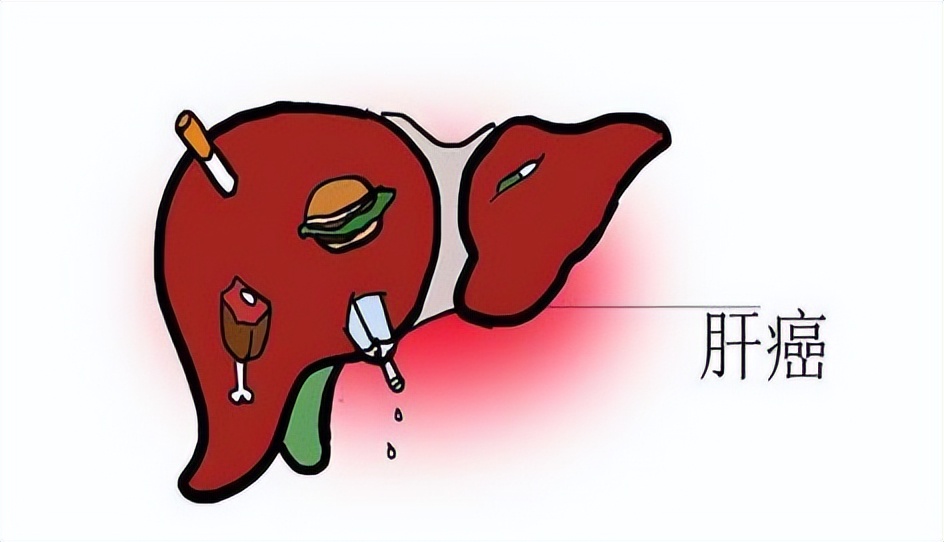 李兰娟院士谈乙肝病毒存活时间,李兰娟院士谈乙肝抗病毒治疗