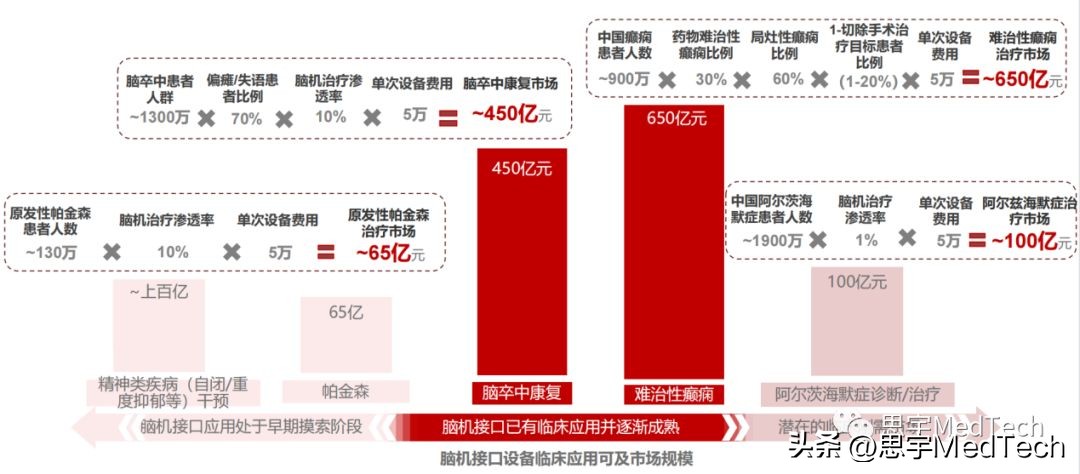 未来的脑机接口技术,全球脑机接口top20