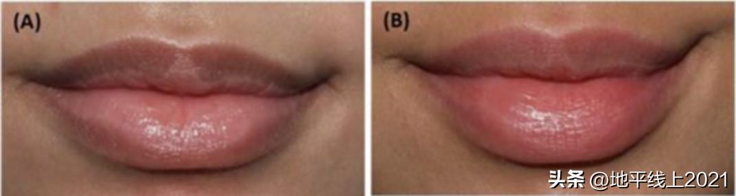 唇色深怎么办怎么变淡,唇色深怎么办四大技巧改善唇色深