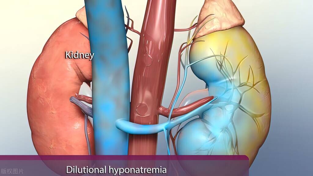 糖尿病干细胞移植能治好费用多少,一型糖尿病干细胞移植可以治愈不
