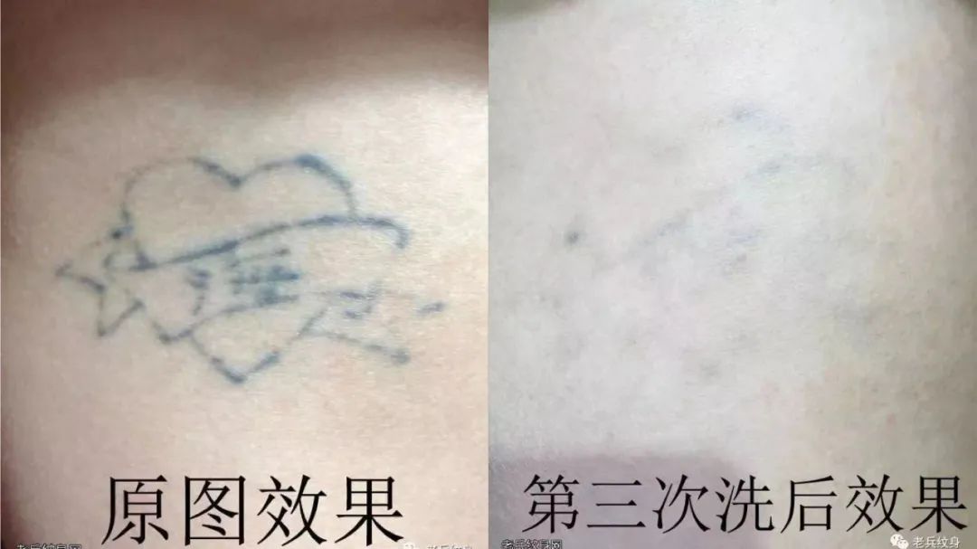 怎样洗纹身对皮肤的损伤小,不伤皮肤的洗纹身方法