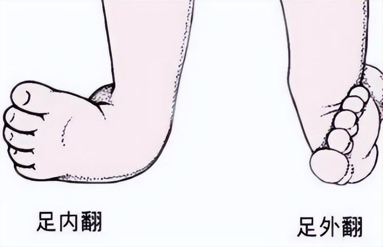 冉冉运动康复训练视频,踝关节康复斜板站立训练方法