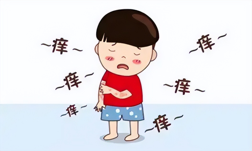 特应性皮炎中医疗法,特应性皮炎忌口食物一览表