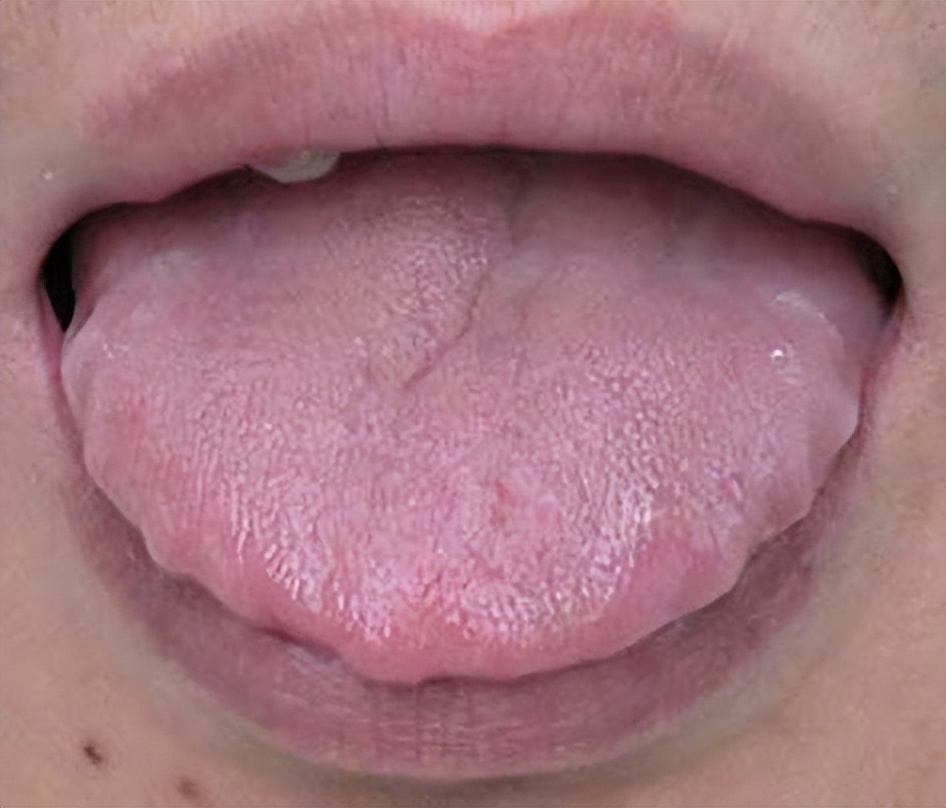 湿气重最好的千古名方,国医大师治湿气最好的方子