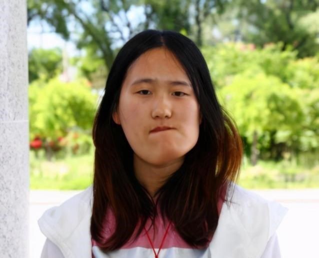 女孩因高烧毁容，后获郭明义帮助整形成功，高颜值引网红公司争抢