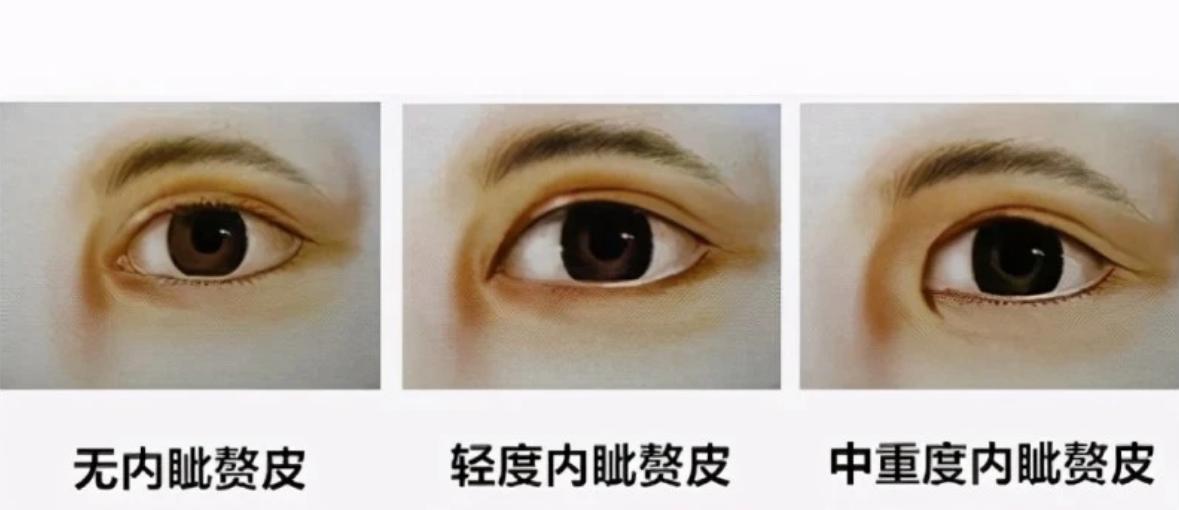 华夏子孙的3个印记：门牙、褶子和脚趾，与生俱来且无法抹去