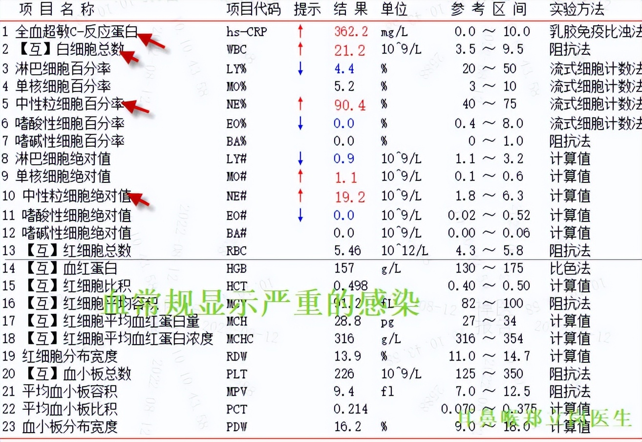 咽喉异物感吞咽困难胃镜检查正常,咽喉不适感越来越强烈怎么治