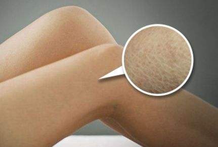 要想皮肤好需要怎么护理,要想皮肤好护理一定少不了