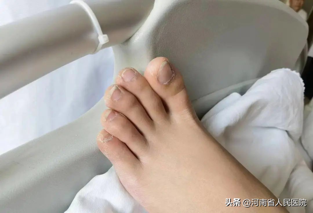 手指缺一大截！“武功加持”的医生，放大招了