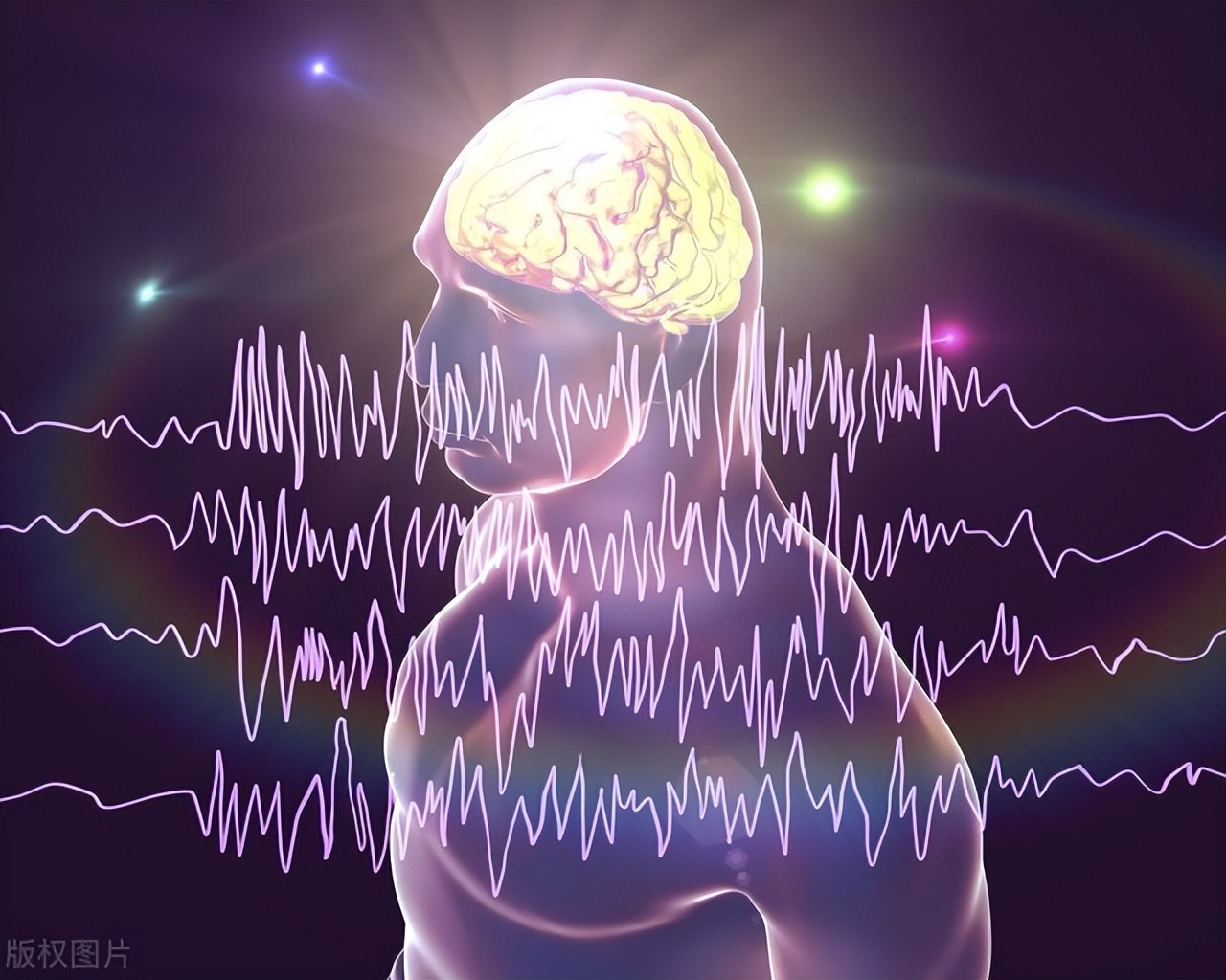 胶质瘤术后出现癫痫意味着什么,胶质瘤和神经母细胞瘤