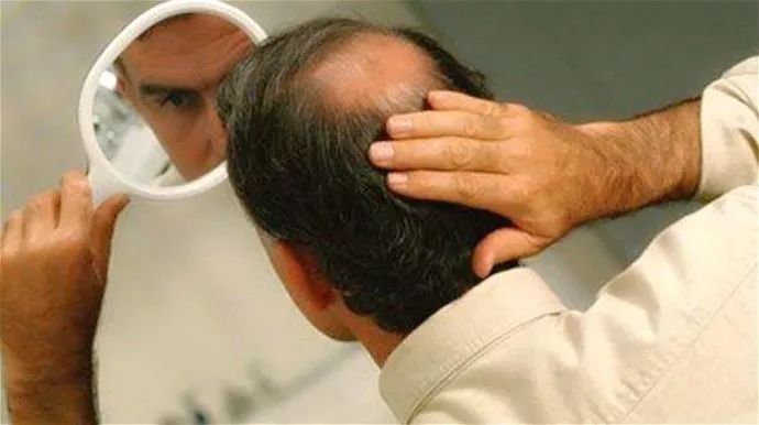 这些生发误区你还在做吗,这些防脱发产品你值得拥有