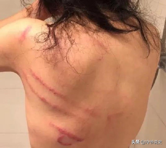 妻子遭丈夫非人折磨抓捕后续,妻子被虐待长达50年