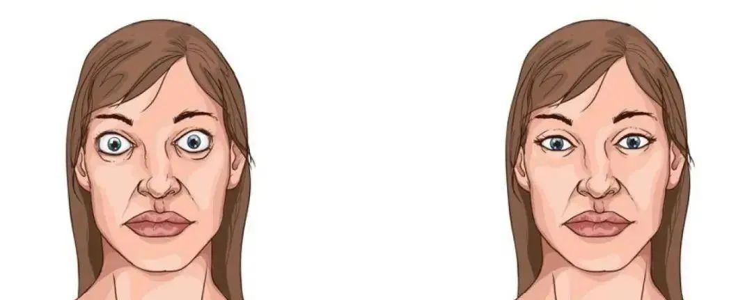 南石医院眼科的斜视手术怎么样,南石医院眼科怎样