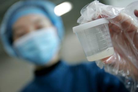 精子有些固体化是怎么回事,精子固体状态