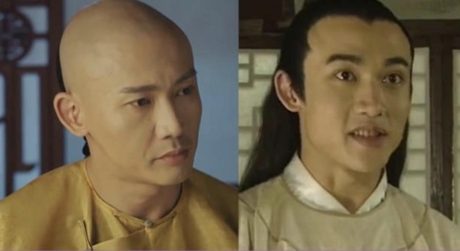 哪些明星整容后遗症越来越严重,整容明星后遗症对比图片