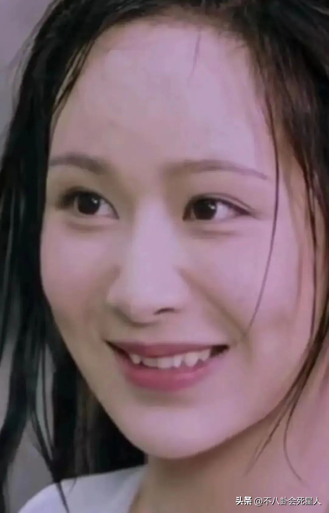 烤瓷牙有多恐怖,烤瓷牙害我一生